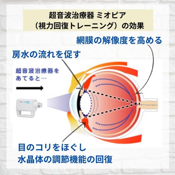 超音波治療器の効果